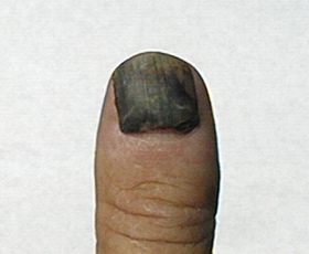 Thumb1.jpg