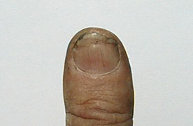 Thumb6.jpg